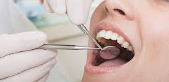 Dental Exam