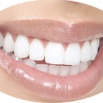 ADG-Aurora_Dentist_TeethWhitening2